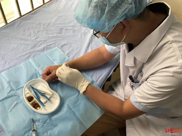 遂寧一院“狠醫生”左手給右手做手術，術后第二天就工作